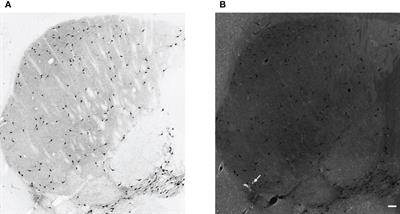 17β-estradiol does not have a direct effect on the function of striatal cholinergic interneurons in adult mice in vitro